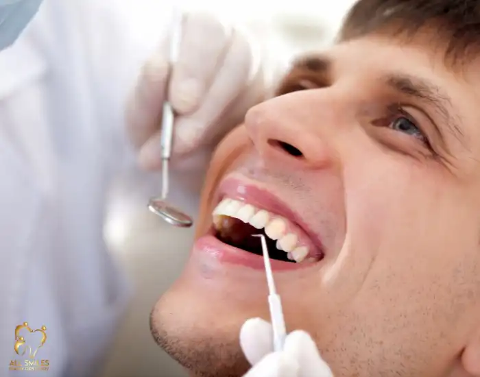 Porcelain veneers for smile makeover Miami FL